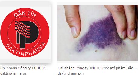 Vi phạm Nghị định số 115, Chi nhánh Công ty TNHH Dược Mỹ phẩm Đắk Tín bị phạt